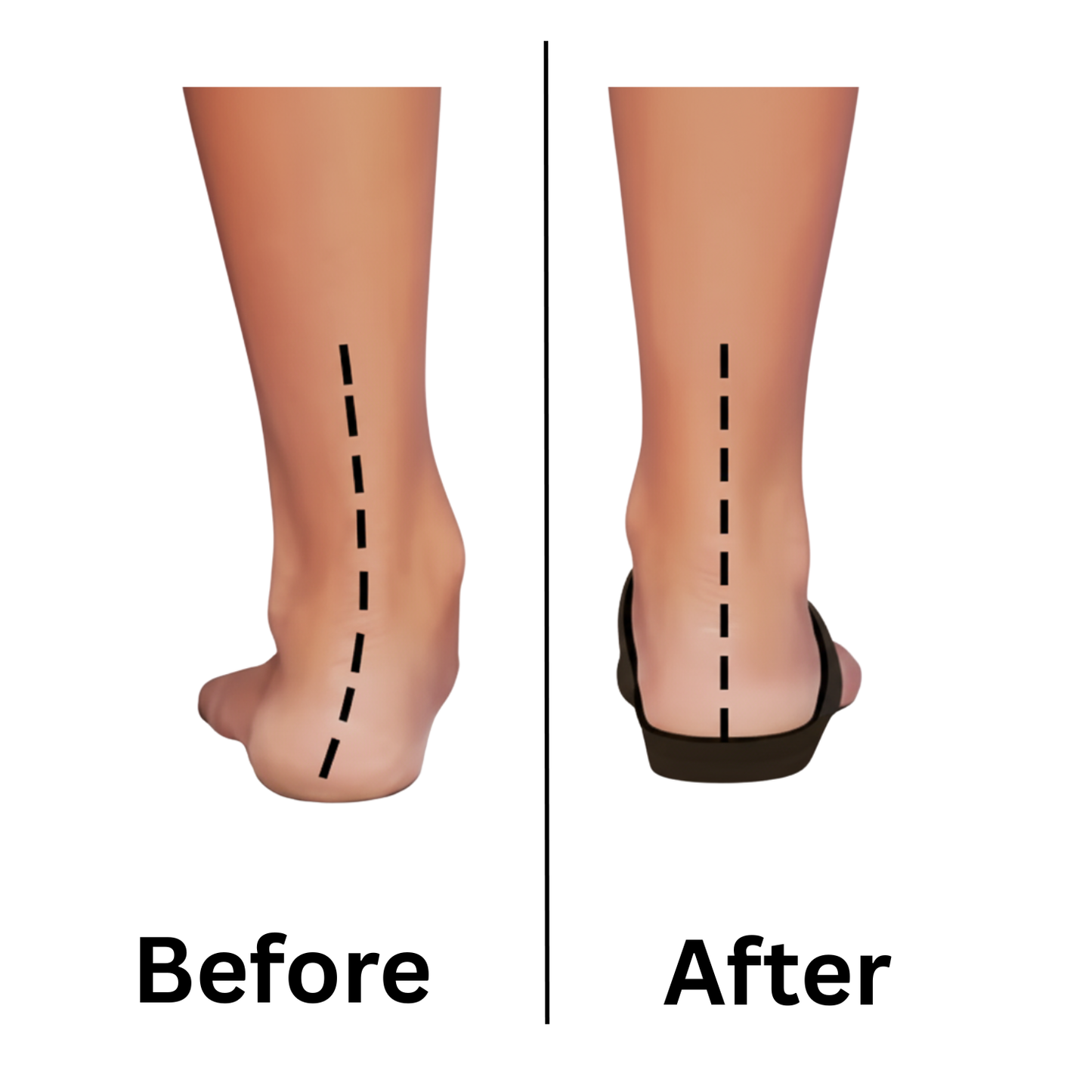 Pathway Pro Foot Acupressure Insoles™